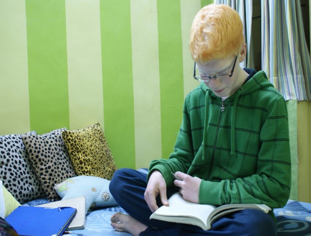 un-awareness-albinism