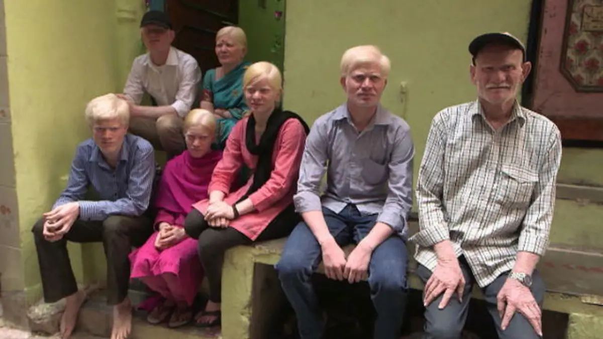 albino-familie-indien