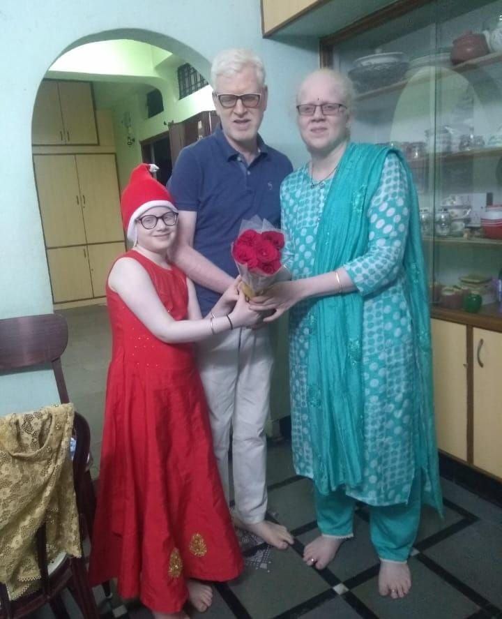 Deepali Jaju's Story as an Albino in India